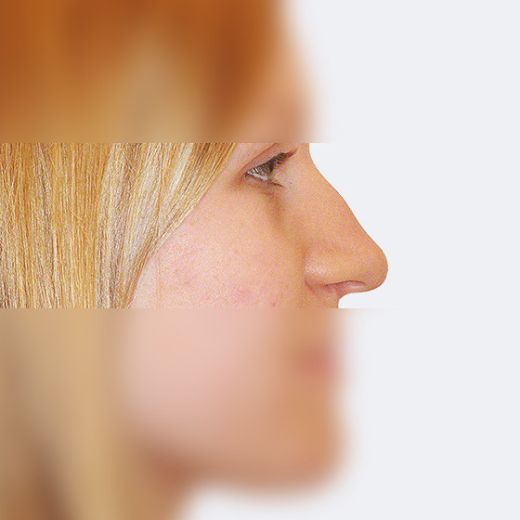 Image before
