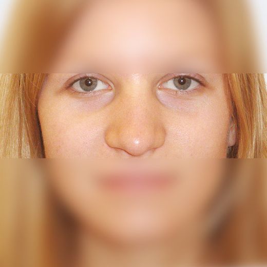 Image before