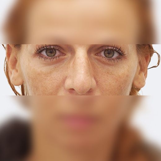 Image before