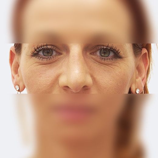 Image after