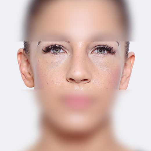 Image after