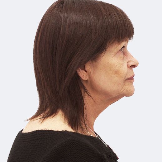 Image before