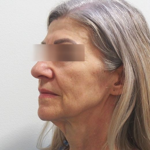 Image before