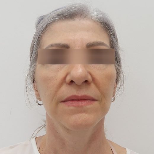 Image before