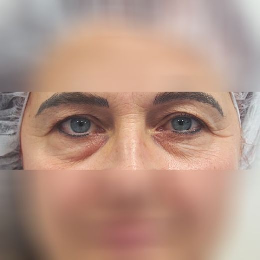 Image before