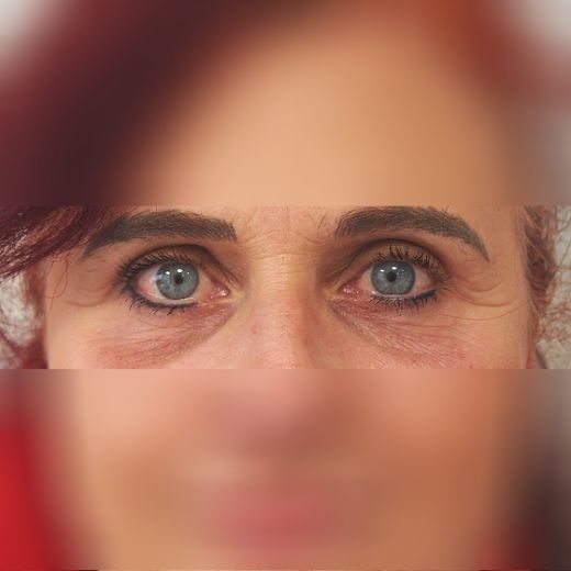 Image after