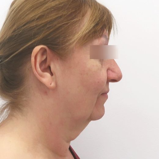 Image before