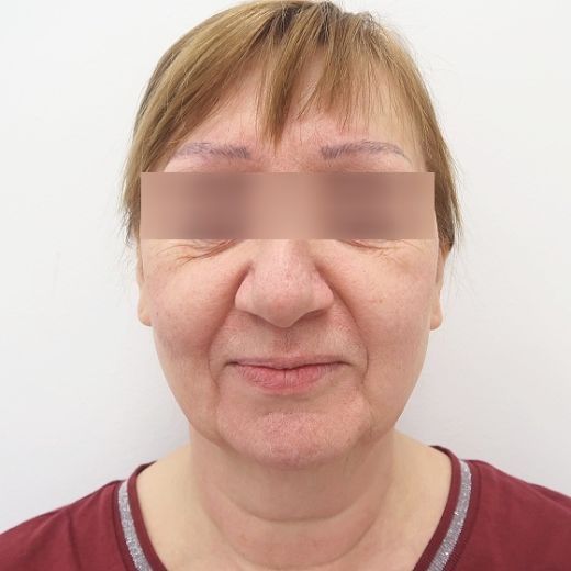 Image before