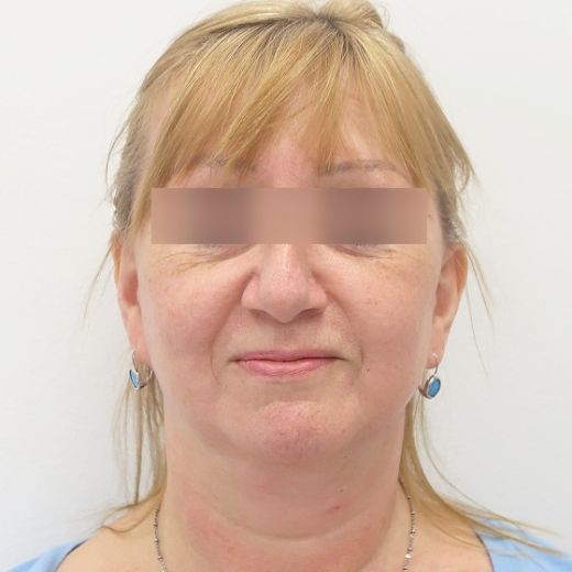 Image after