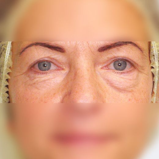 Image before