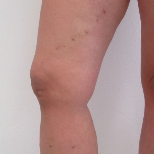 Image after