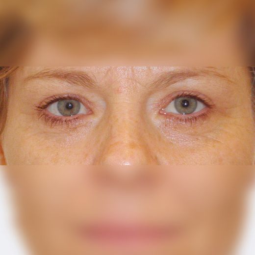 Image after