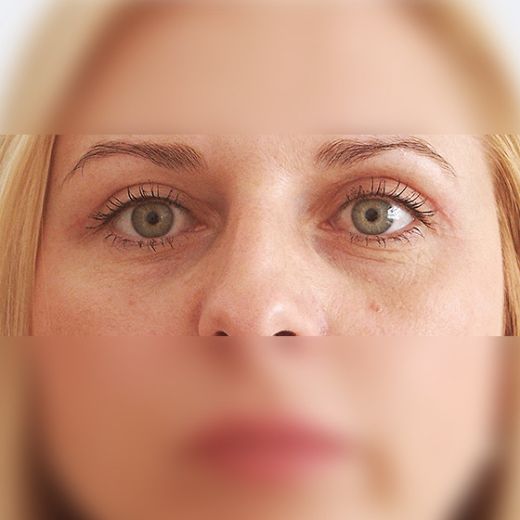 Image after
