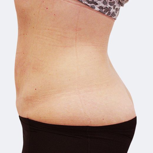 Image after