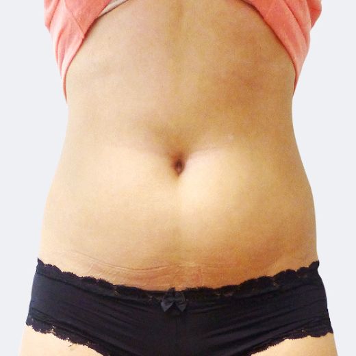 Image before