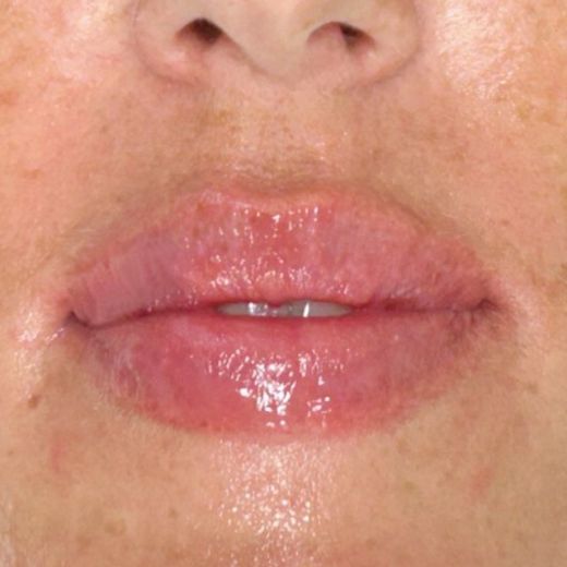 Image after