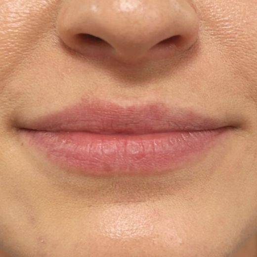 Image before