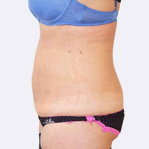 Image after
