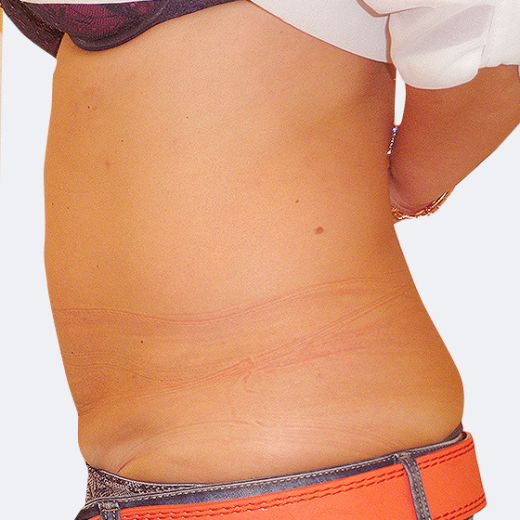 Image after