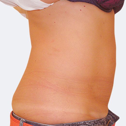 Image after