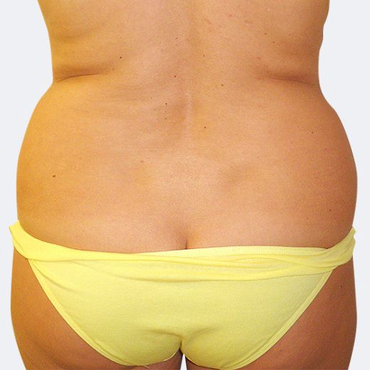 Image before