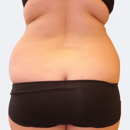 Image before