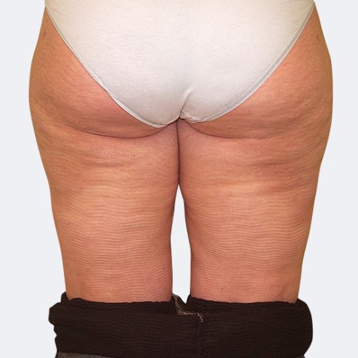 Image after