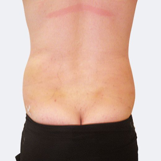 Image after