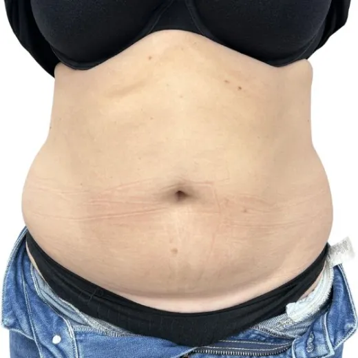 Image before