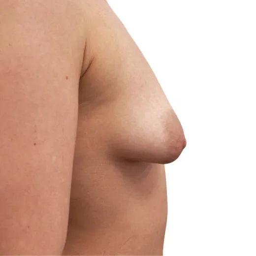 Image before