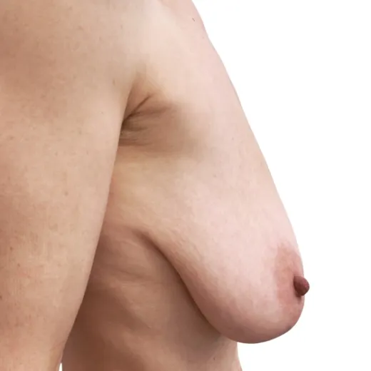Image before