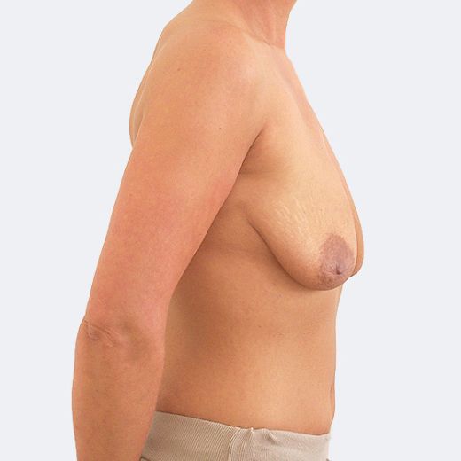 Image before