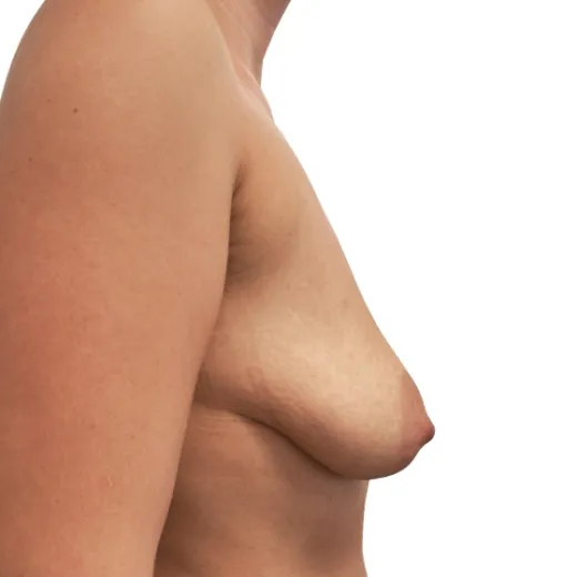 Image before