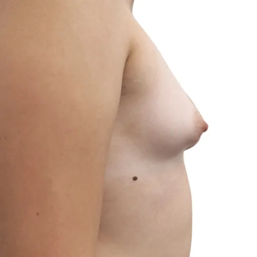 Image before