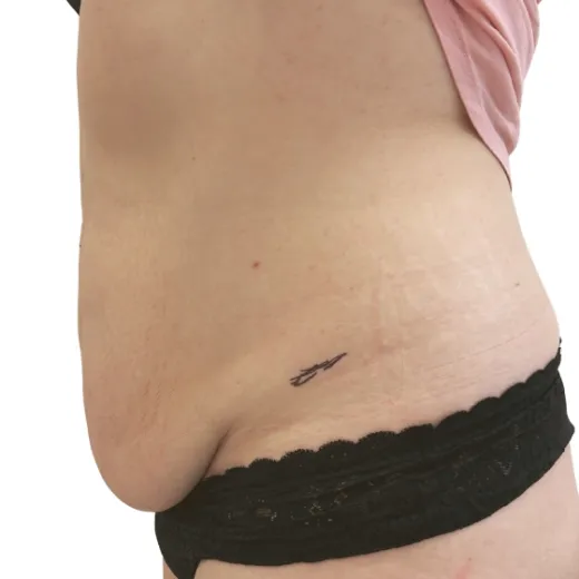 Image before