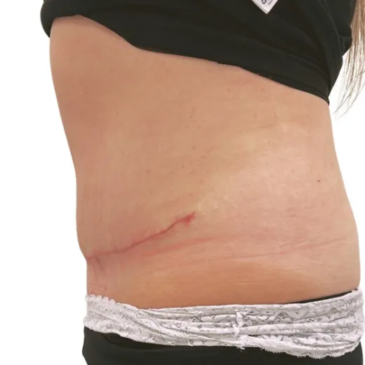 Image after