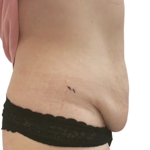 Image before
