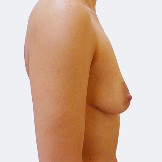 Image before