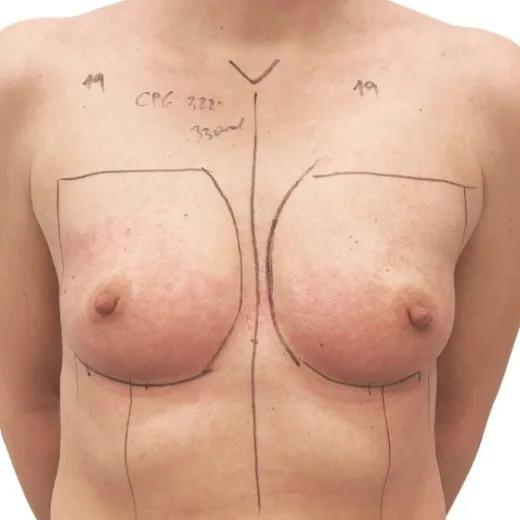 Image before