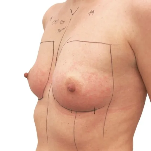 Image before