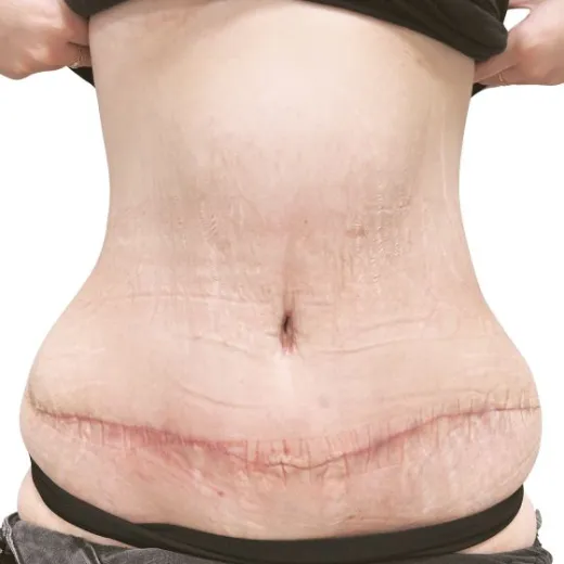 Image after