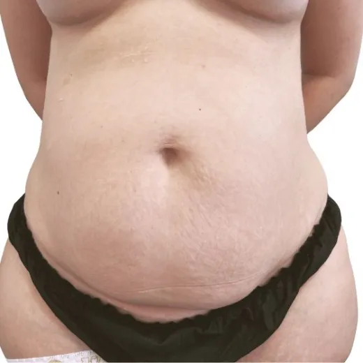 Image before