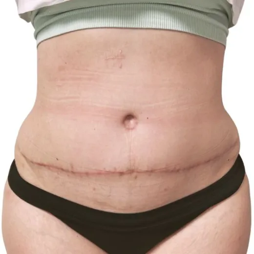 Image after