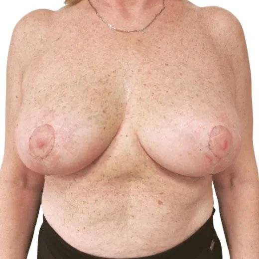 Image after