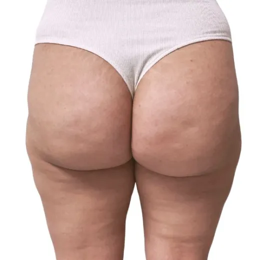 Image after
