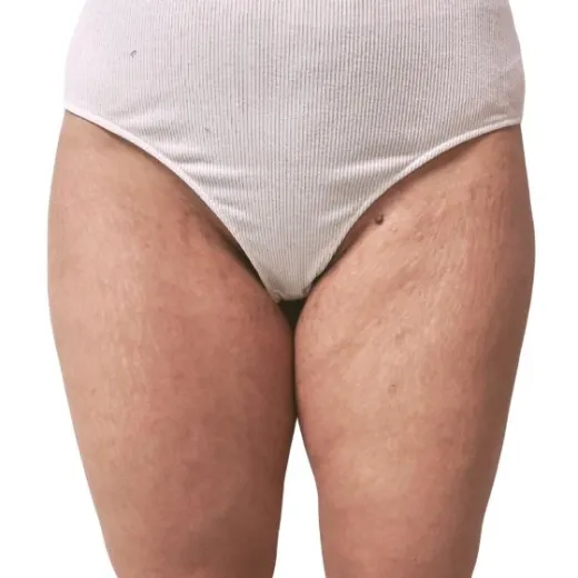 Image after