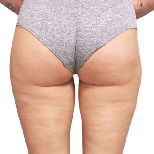 Image after