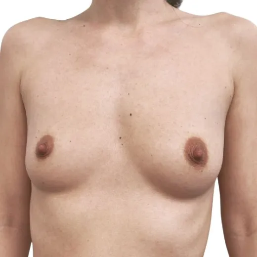 Image before