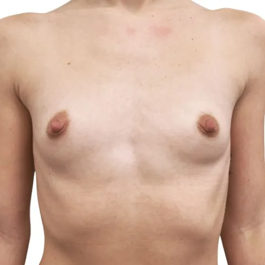 Image before