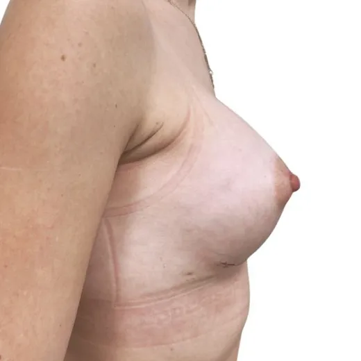 Image after